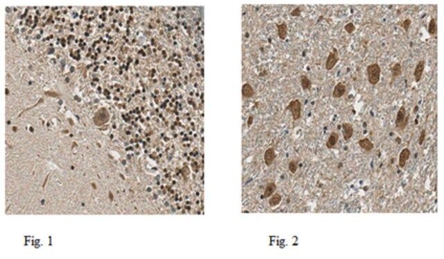 Anti-NSD2 Antibody
