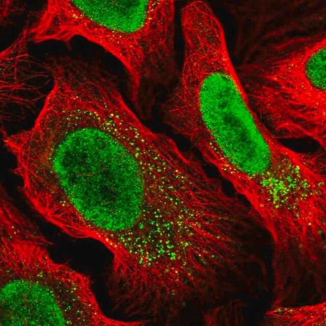 Anti-MYCBP2 antibody produced in rabbit
