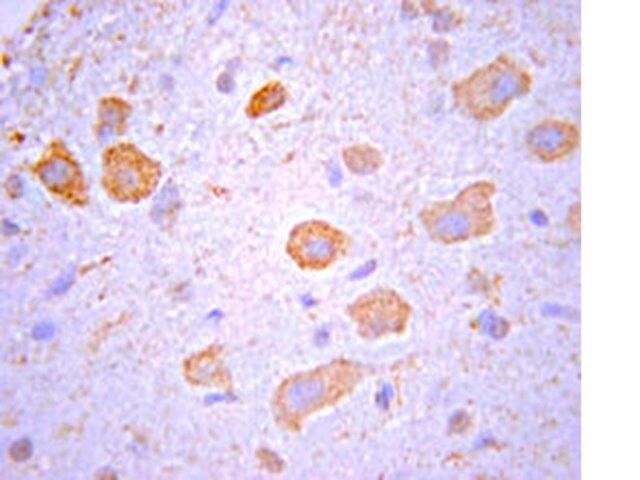 Anti-Nogo Receptor Antibody