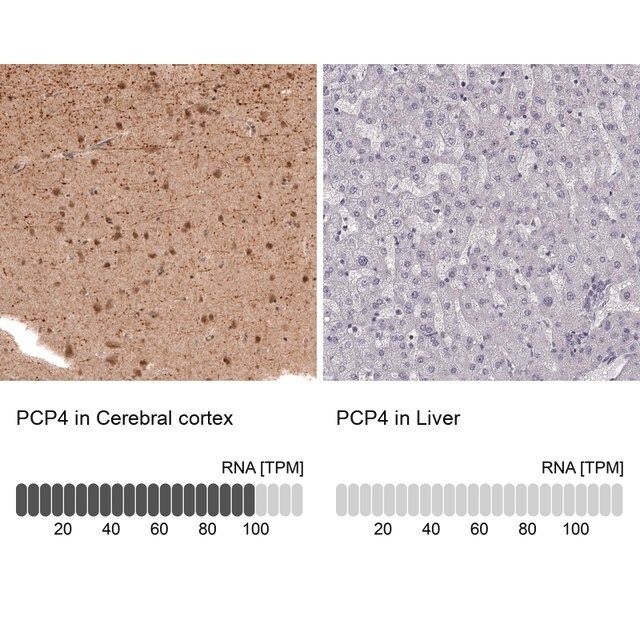 Anti-PCP4 antibody produced in rabbit
