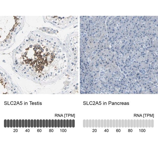 Anti-SLC2A5 antibody produced in rabbit