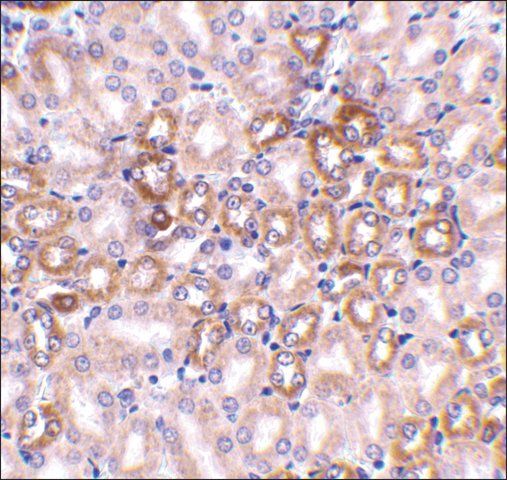 Anti-Nephrin antibody produced in rabbit