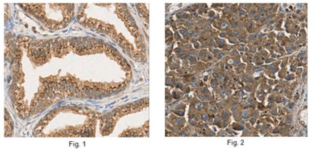 Anti-ST6GAL1 Antibody