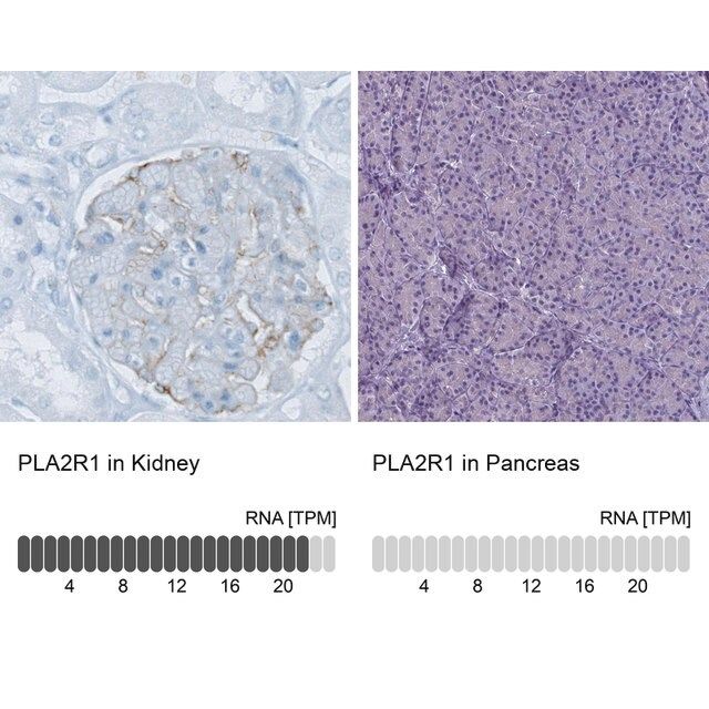 Monoclonal Anti-PLA2R1 antibody produced in mouse