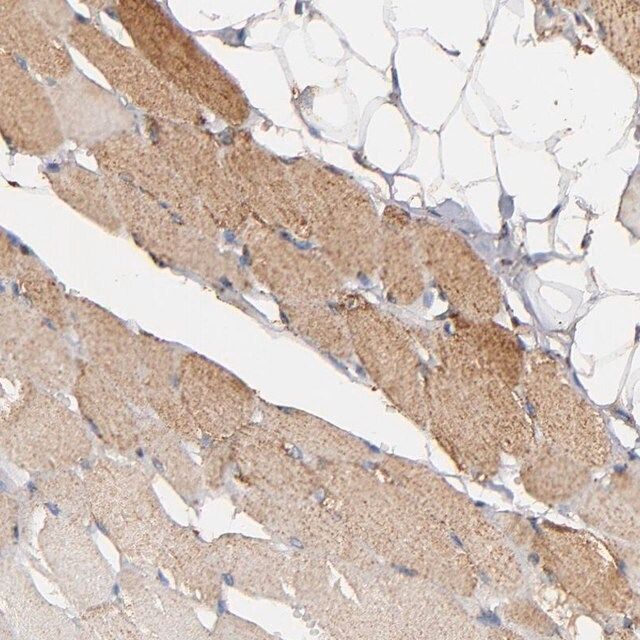 Anti-SOD2 antibody produced in rabbit