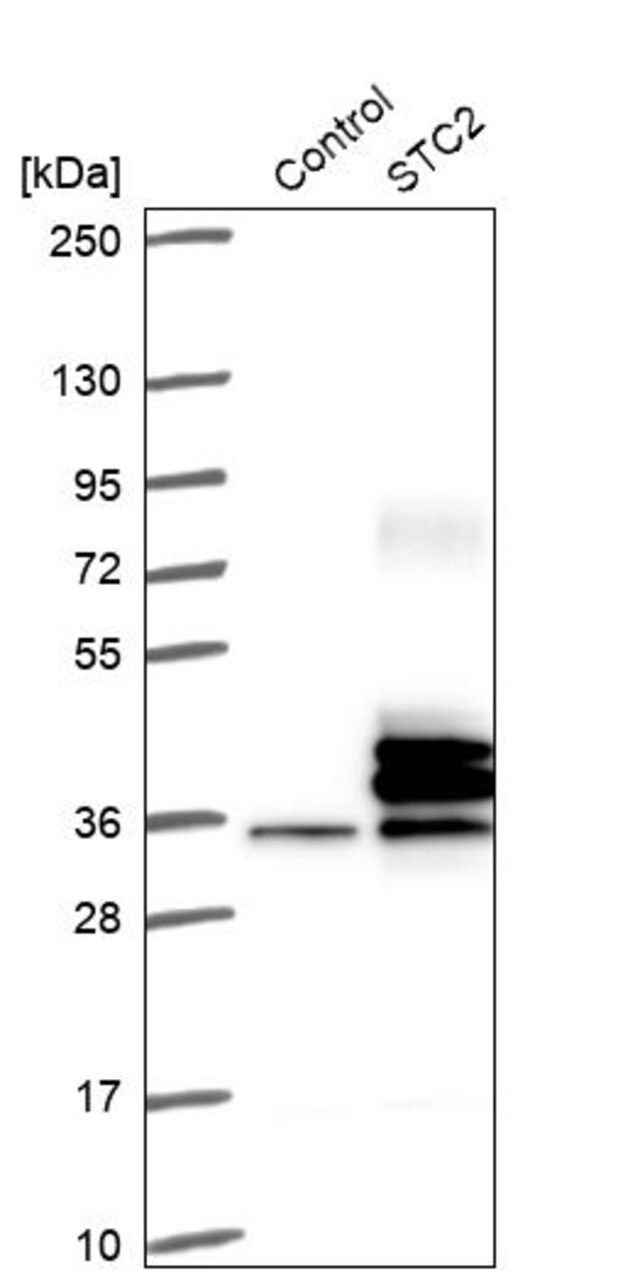 Anti-STC2 antibody produced in rabbit