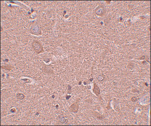 Anti-SRPX1 antibody produced in rabbit