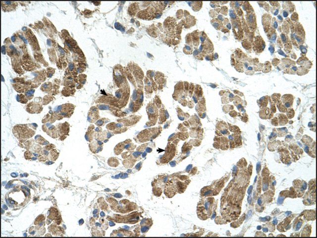 Anti-RHOT1 antibody produced in rabbit
