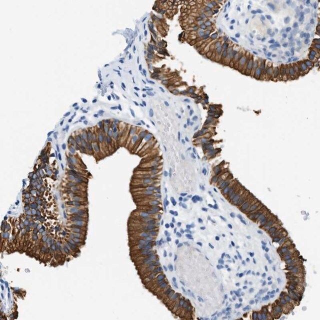 Anti-STXBP2 antibody produced in rabbit