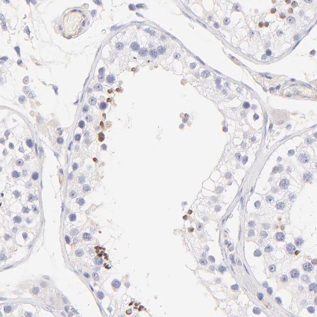 Anti-ACTRT1 antibody produced in rabbit