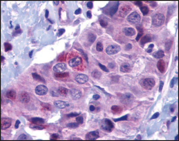 Anti-PUMA (ab2) antibody produced in rabbit