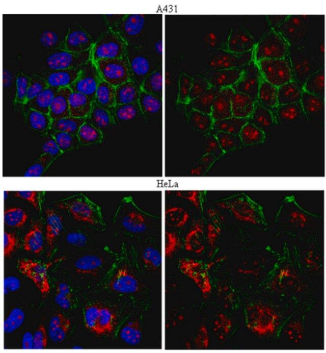 Anti-RAD51 Antibody