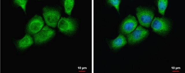 Anti-PLAUR antibody produced in rabbit