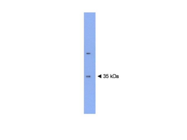 Anti-Plasticity Related Gene 3 Antibody