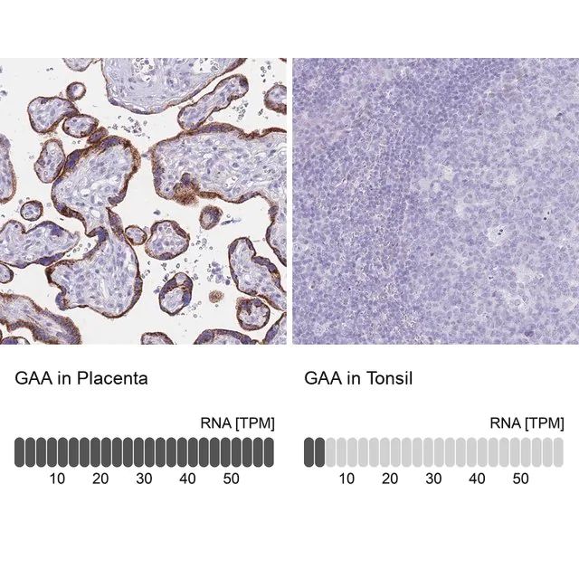 Anti-GAA antibody produced in rabbit