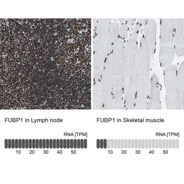 Anti-FUBP1 antibody produced in rabbit