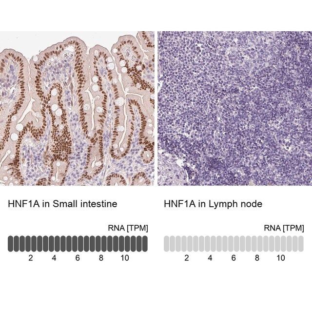 Anti-HNF1A antibody produced in rabbit
