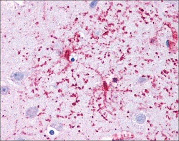 Anti-GLUD1