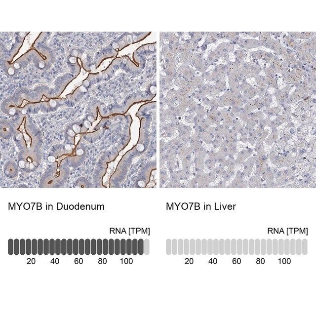 Anti-MYO7B antibody produced in rabbit
