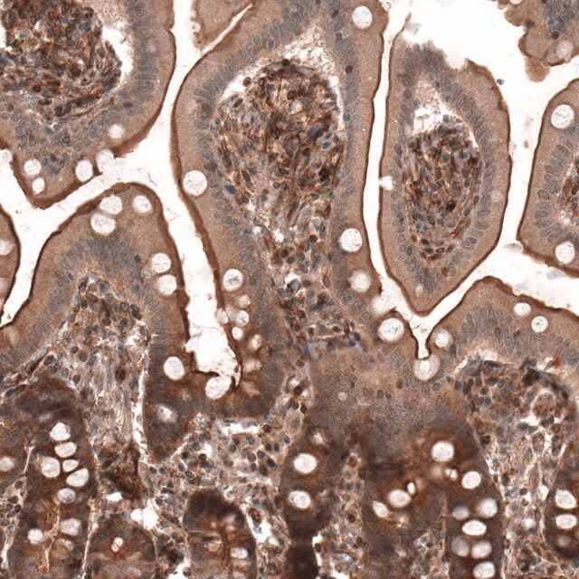 Anti-IL17RE antibody produced in rabbit