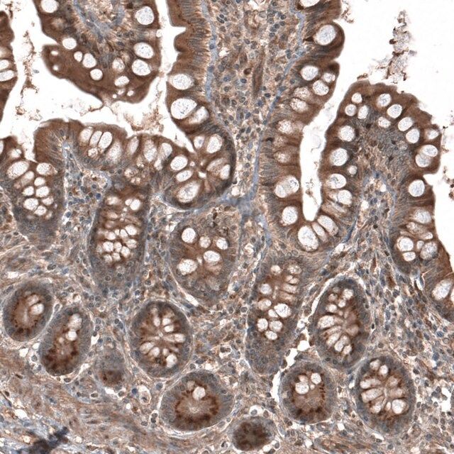 Anti-HMGCR antibody produced in rabbit