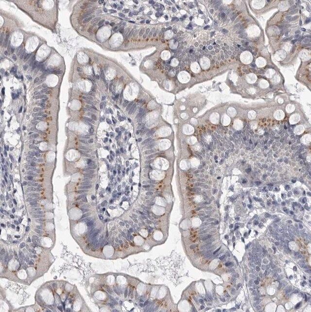Anti-MYOC antibody produced in rabbit