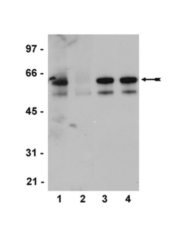 Anti-phospho-Src family (Tyr416) Antibody, clone 2N8, rabbit monoclonal