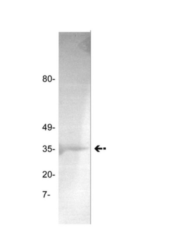 Anti-Thrombin Antibody, clone GMA-020