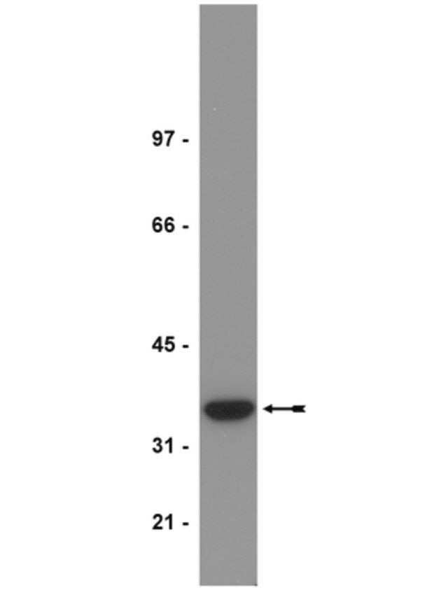 Anti-PP2A Antibody, C subunit, demethylated, clone 4b7
