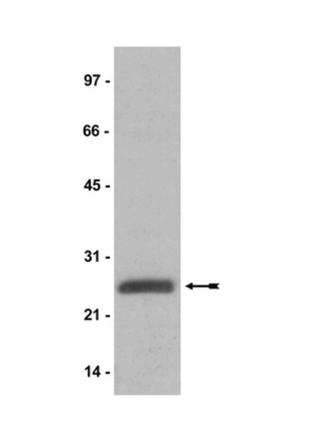 Anti-ubiquityl-Histone H2A Antibody, clone E6C5