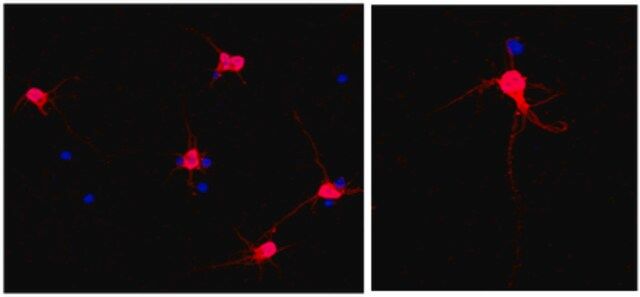 Anti-MAP2 Antibody, clone AP20, Alexa Fluor<sup>®</sup> 555 Conjugate