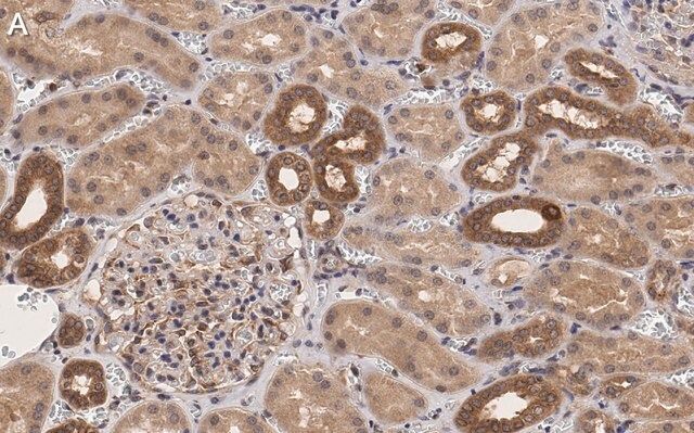 Anti-TSC2 Antibody, clone 4H10 ZooMAb<sup>®</sup> Rabbit Monoclonal