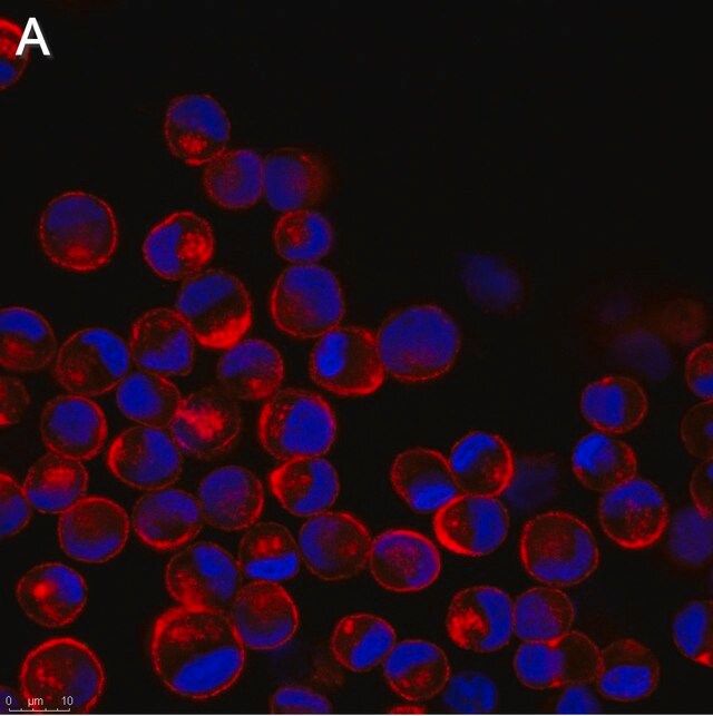 Anti-Influenza A Nucleoprotein Antibody, clone A3 ZooMAb<sup>®</sup> Mouse Monoclonal