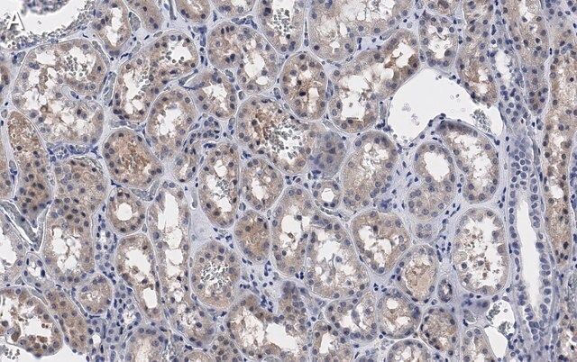 Anti-PP2A C subunit Antibody, clone 2B15 ZooMAb<sup>®</sup> Rabbit Monoclonal