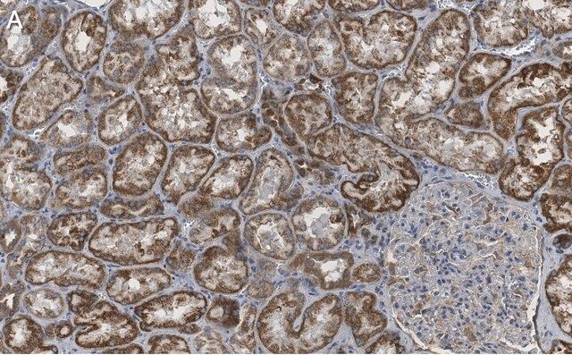 Anti-ULK2 Antibody, clone 3E19 ZooMAb<sup>®</sup> Rabbit Monoclonal