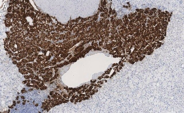 Anti-Dopamine β Hydroxylase Antibody, clone 2B11 ZooMAb<sup>®</sup> Rabbit Monoclonal