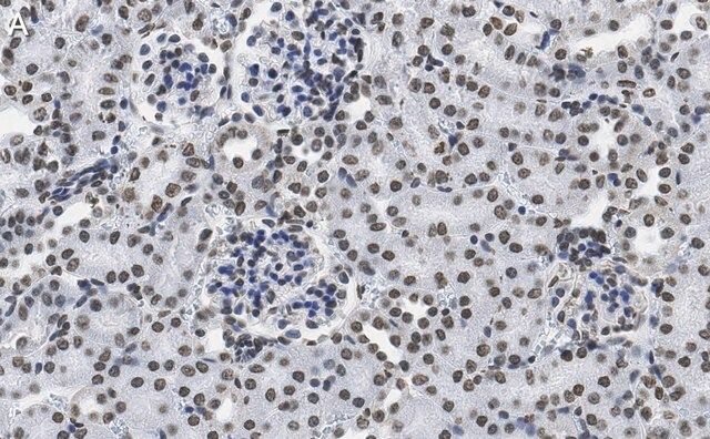 Anti-DNA G-quadruplex (G4) Antibody, clone 1H6 ZooMAb<sup>®</sup> Mouse Monoclonal