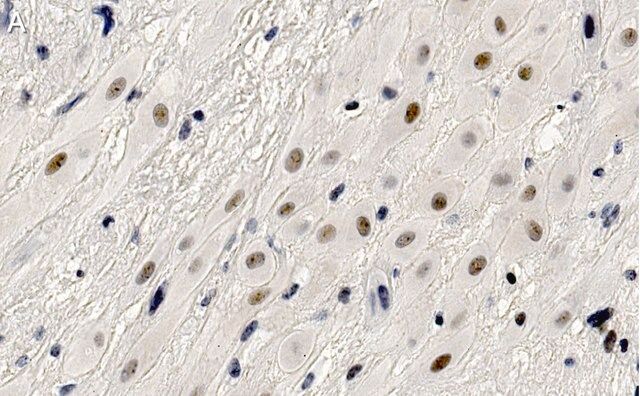 Anti-HDAC7 Antibody, clone 1L17 ZooMAb<sup>®</sup> Rabbit Monoclonal