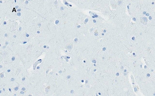 Anti-Huntingtin Protein Antibody, clone 1M11, ZooMAb<sup>®</sup> Rabbit Monoclonal