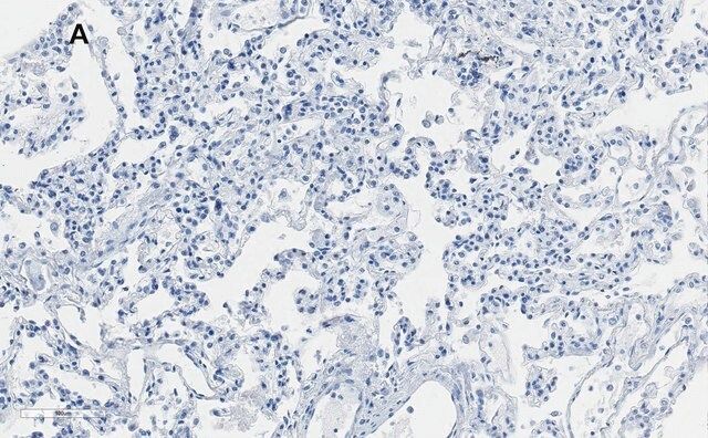 Anti-Integrin alpha V beta 6 Antibody, clone EM05201, ZooMAb<sup>®</sup> Rabbit Monoclonal