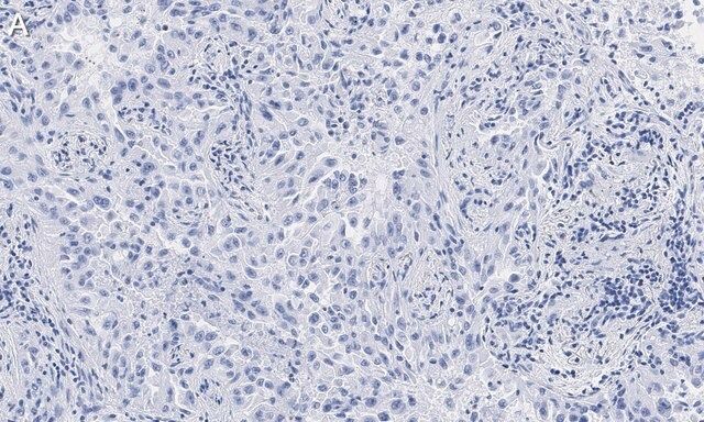 Anti-Integrin αVβ8 Antibody, clone EM13309 , ZooMAb<sup>®</sup> Rabbit Monoclonal