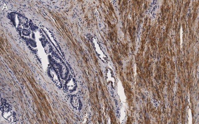 Anti-Vinculin Antibody, clone 3M13 ZooMAb<sup>®</sup> Rabbit Monoclonal