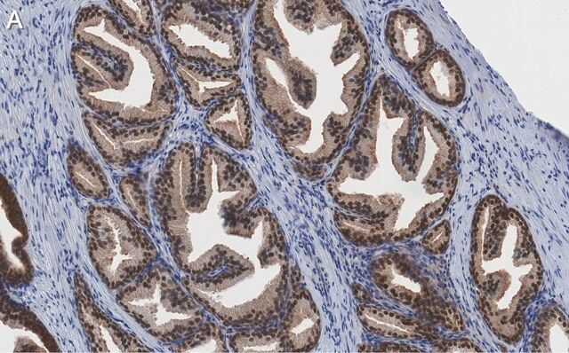 Anti-PRMT5 Antibody, clone 1H16 ZooMAb<sup>®</sup> Rabbit Monoclonal