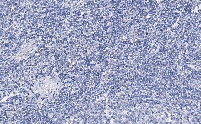 Anti-vWF Antibody, clone 1B21, ZooMAb<sup>®</sup> Rabbit Monoclonal