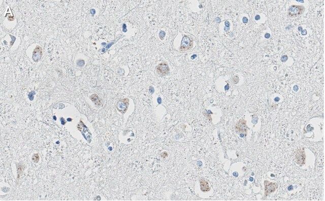 Anti-APP Antibody, clone 1F22 ZooMAb<sup>®</sup> Rabbit Monoclonal
