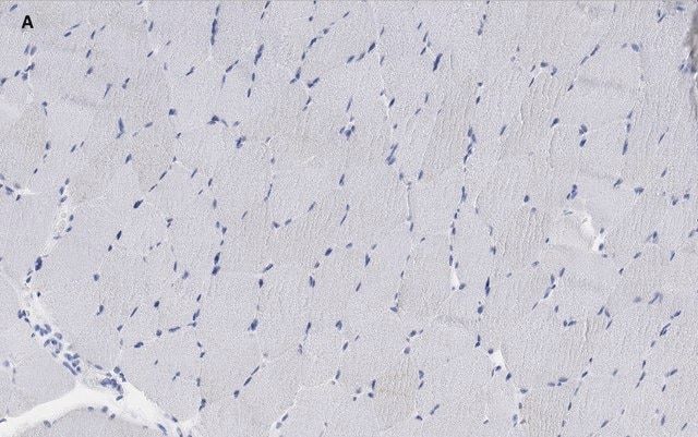 Anti-alpha Actinin 2 Antibody, clone 1E11, ZooMAb<sup>®</sup> Rabbit Monoclonal
