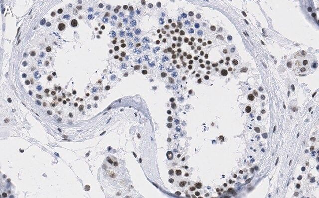 Anti-DAXX Antibody, clone 1L6 ZooMAb<sup>®</sup> Rabbit Monoclonal