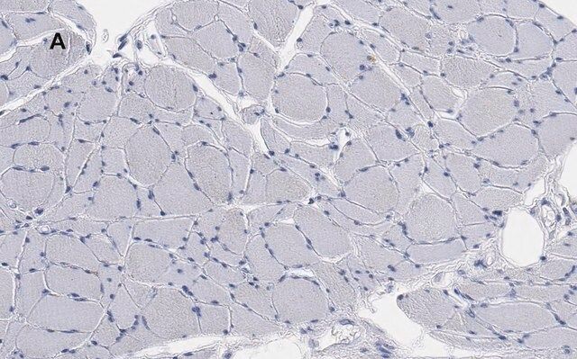 Anti-Desmin Antibody, clone 1H16, ZooMAb<sup>®</sup> Rabbit Monoclonal