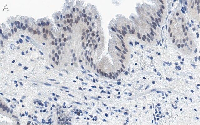 Anti-Nrf2 Antibody, clone 5B20 ZooMAb<sup>®</sup> Rabbit Monoclonal