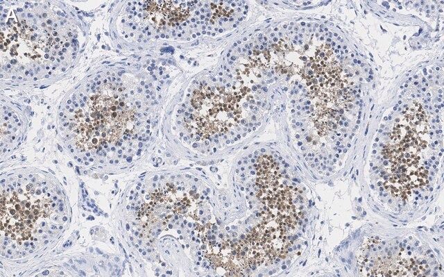 Anti-PPP3CC Antibody, clone 2C2 ZooMAb<sup>®</sup> Rabbit Monoclonal